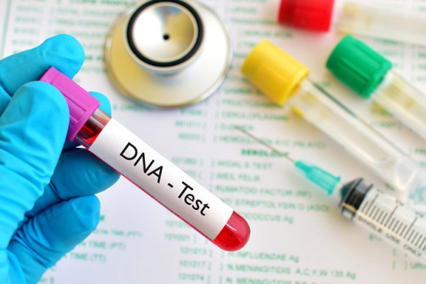 Диагностический набор ДНК | Iran Exports Companies, Services & Products | IREX
